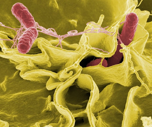Atherosclerosis severity predicts the risk of Non-typhoidal Salmonella vascular infection