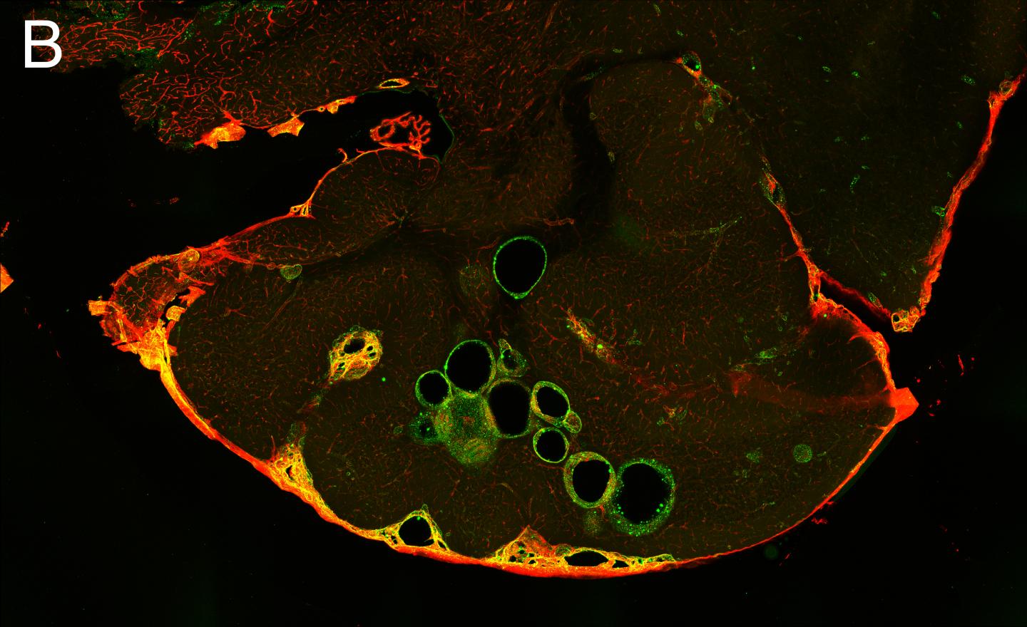 Brain section propranolol