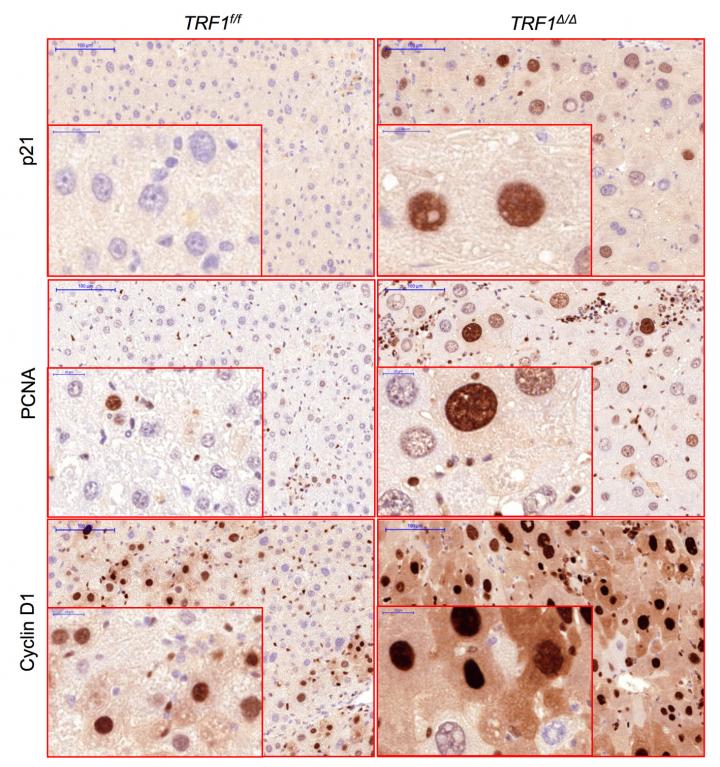 Liver Cells