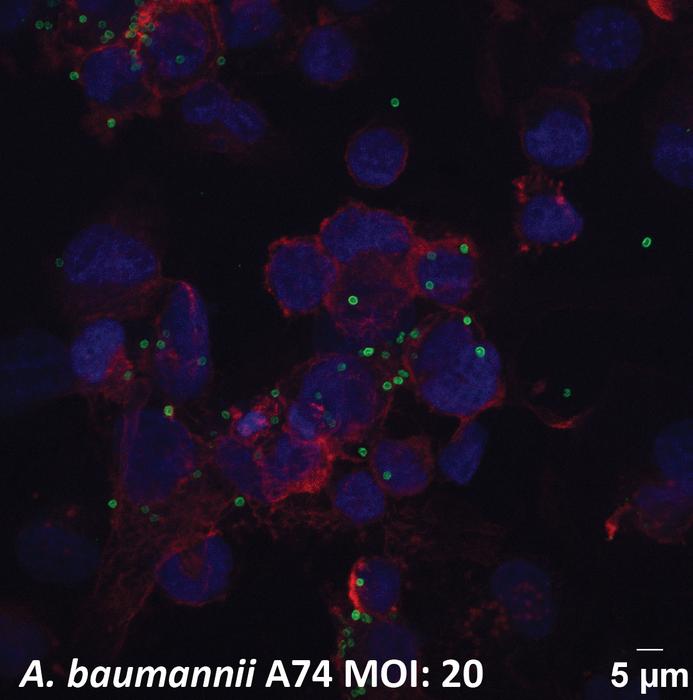 Immunofluoresence microscopy of A. baumannii bacteria