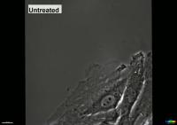 Synoviocyte Migration