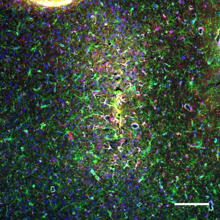 OPC Activation Around Chronic Brain Implant