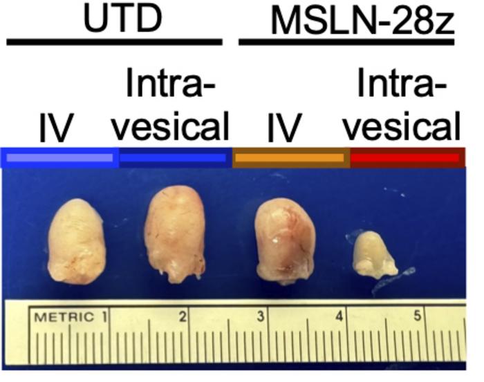 CAR T cells reduce bladder tumor size
