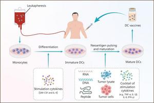 Overview of the manufacturing process of personalized neoantigen-based DC vaccines.