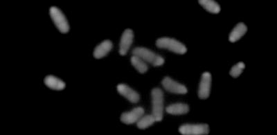 Chromosomes