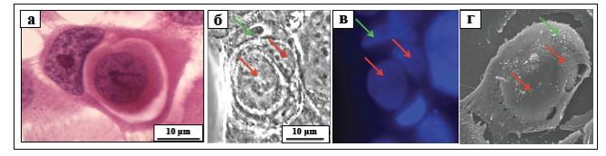 Entosis in the Culture of Human Skin Cells