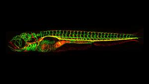 Zebrafish study shows promise for lymphoedema