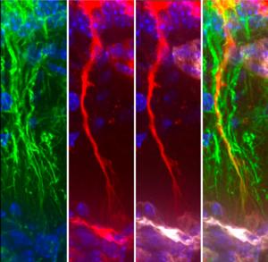Tanycytes capturing Tau proteins