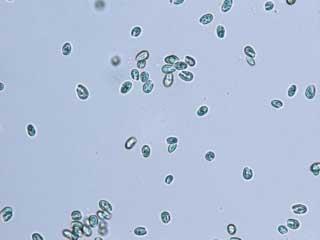 Cryptophyte Algae