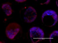 Infected Liver Cells