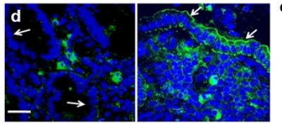 Protein S-Nitrosylation in Human Colitis