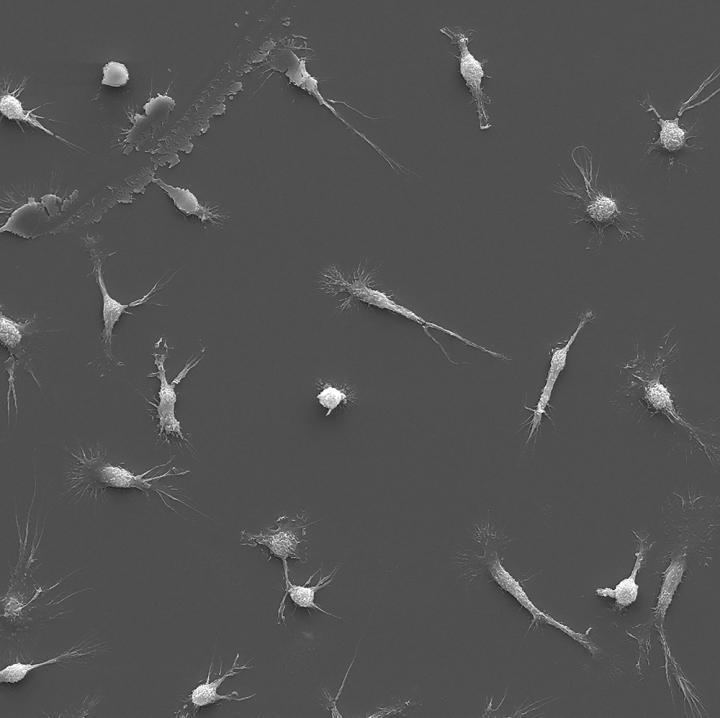 White Blood Cell Macrophages
