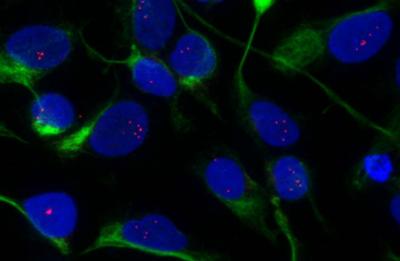 Study Sheds Light on Underlying Causes of Impaired Brain Function in Muscular Dystrophy