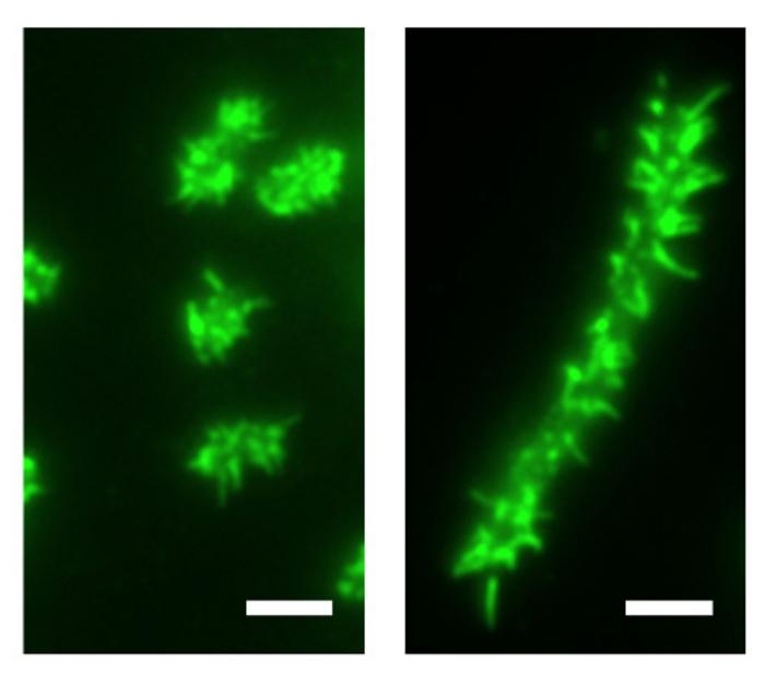 Image 3 – "hairy" bacteria