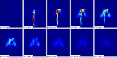 Penn -- New Lung Imaging Techniques