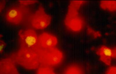 Chlamydia