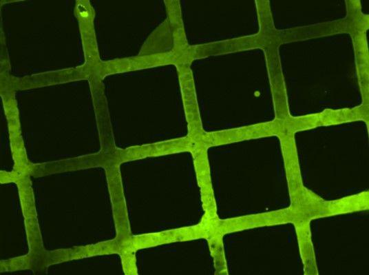 Biodegradable Polymer Coating for Implants