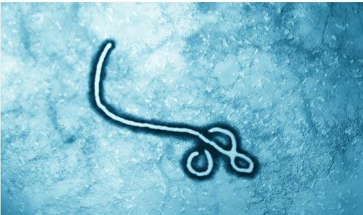 Ebola