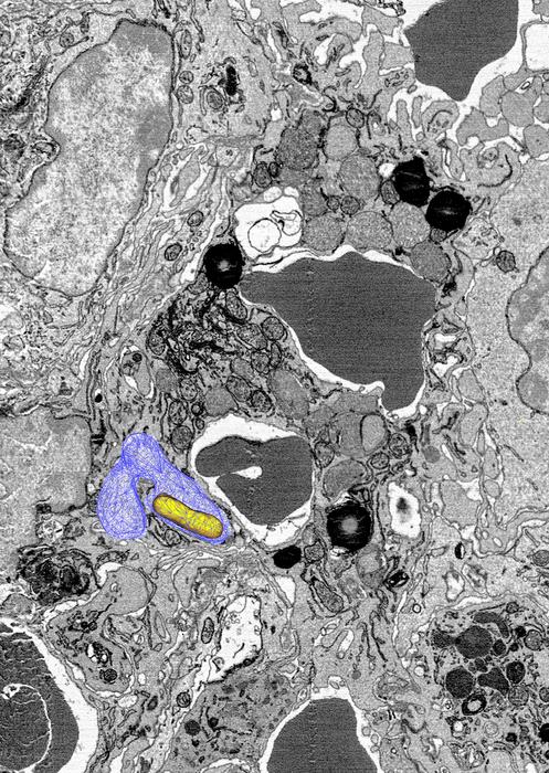 Salmonella in a macrophage