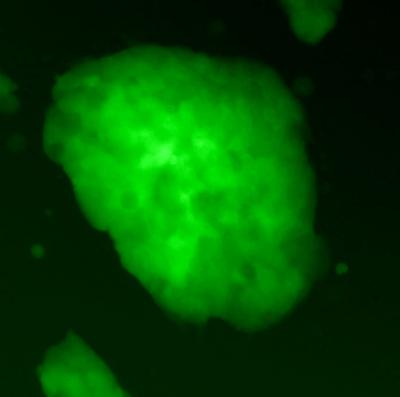 Stem Cells Without the Side Effects 1 of 2