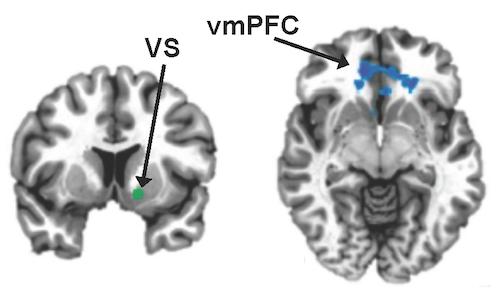 vmPFC-VS