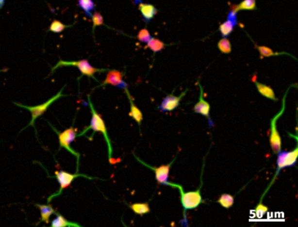 From Skin to Brain: Stem Cells Without Genetic Modification (2 of 2)