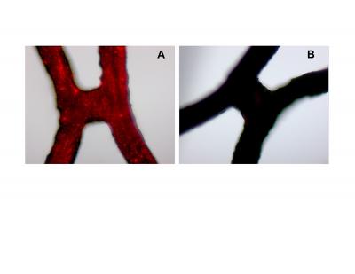 Vascular Stent