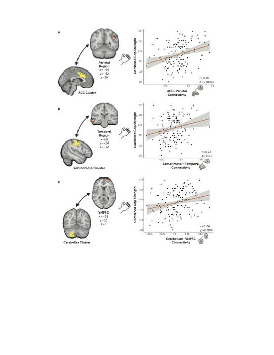 Brain networks
