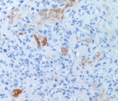 Apoptotic Cells