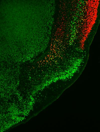 Genetics of Patterning the Cerebral Cortex