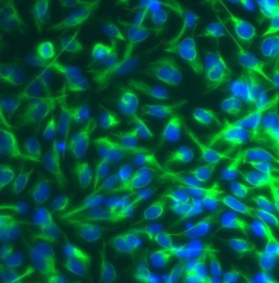 Neural Stem Cells