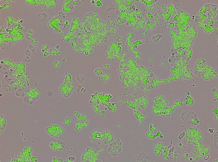 Human Breast Cancer Cells