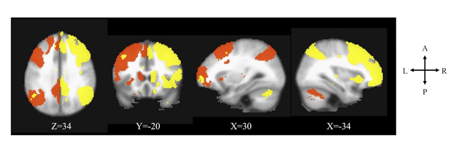 Brain Scans