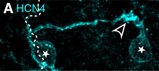 Bipolar Cell Dendrites