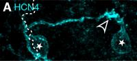 Bipolar Cell Dendrites