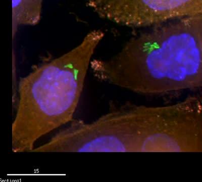 Bacteria in Tumors May Reduce the Efficacy of Cancer Chemotherapy (6 of 6)