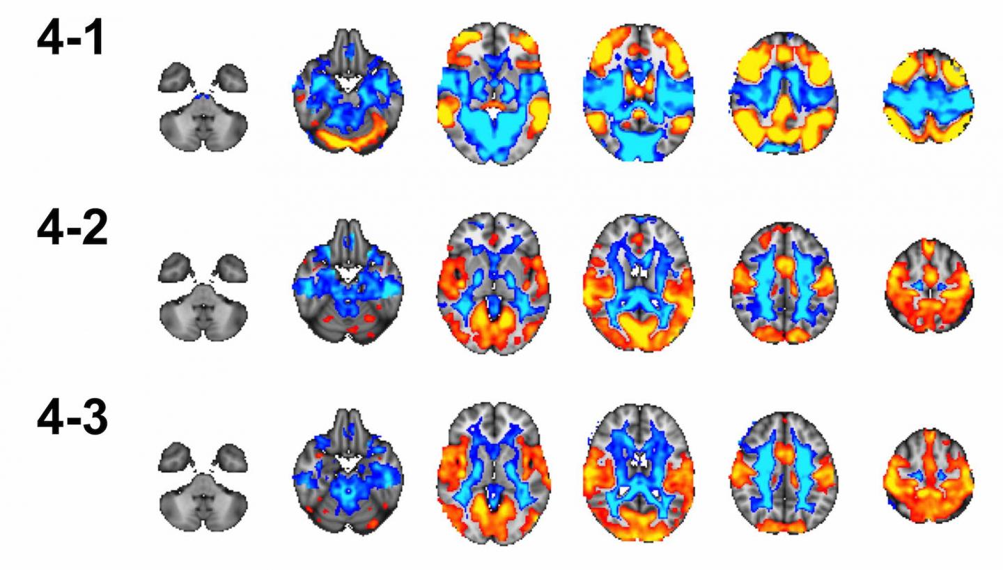 Efficient Teen Brain