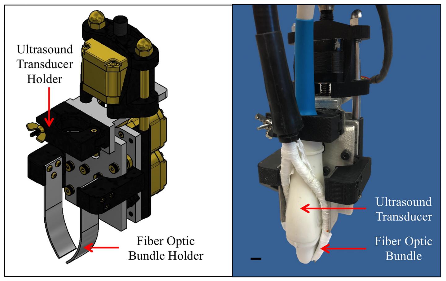Ultrasound Transducer