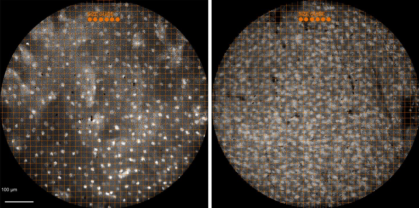 High-Resolution Microendoscope