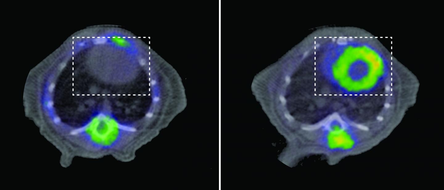 CNIC Researchers Discover Link Between A Mitochondrial Defect And Heart Disease