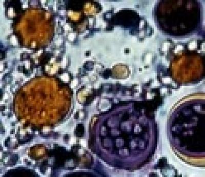 Microalgae