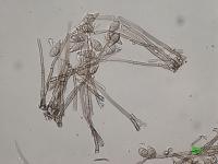 Wheat Blast Spore