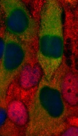 STAT2: Much More Than an Antiviral Protein