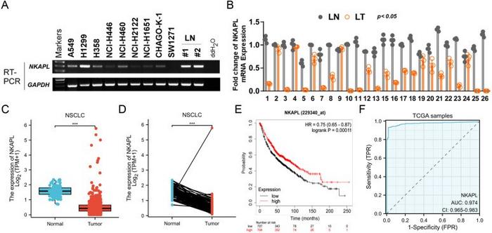 NKAPL is down-regulated in NSCLC tissues and is associated with poor prognosis.