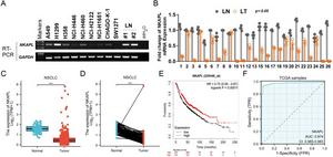 NKAPL is down-regulated in NSCLC tissues and is associated with poor prognosis.
