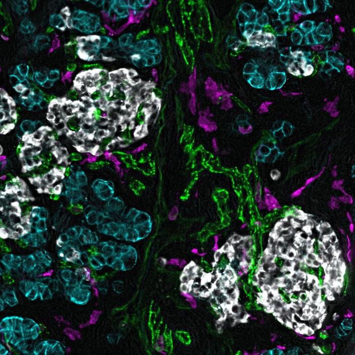 Unlocking diabetes’ secrets: Pediatric organ donors  help map a path to a cure and prevention