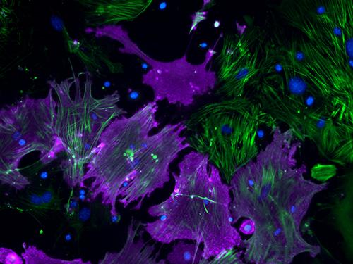 Fibroblasts