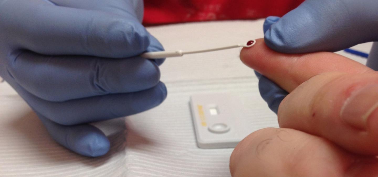 Rapid HIV Test