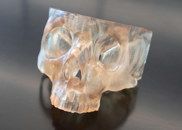 Precision Surgery: Custom 3D-Printed Models Improve Tumor Removal, Cut Cancer Return Risk