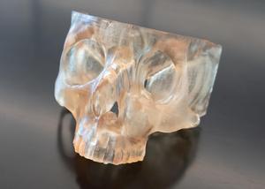Precision Surgery: Custom 3D-Printed Models Improve Tumor Removal, Cut Cancer Return Risk